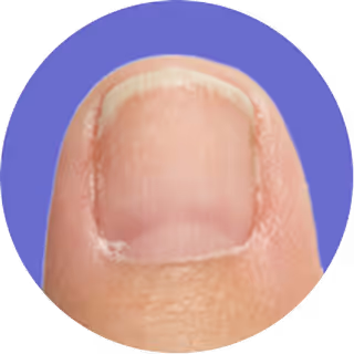 Close-up of a fingernail with a blue circular background